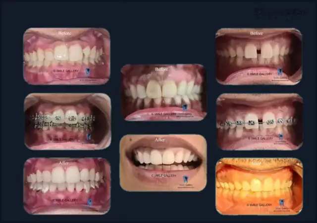 Smile case 10: before and after photos, shared with the patient’s consent