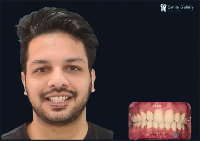 Smile case 7: before and after photos, shared with the patient’s consent