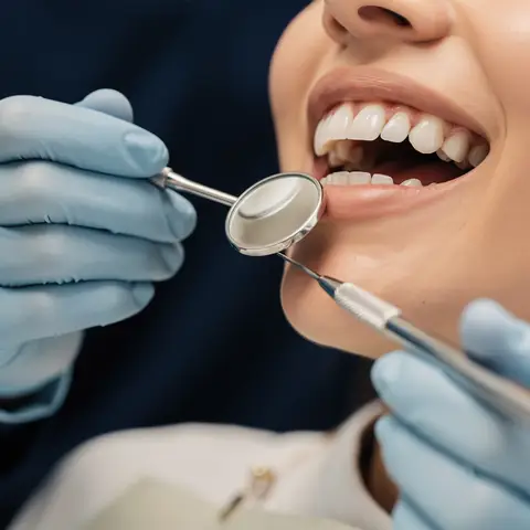 Root canal treatment at Smile Gallery, Bhopal