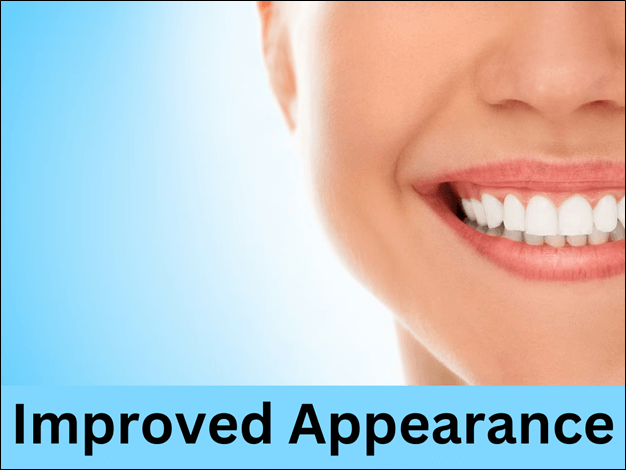 Dental Implants in Bhopal: What You Need to Know