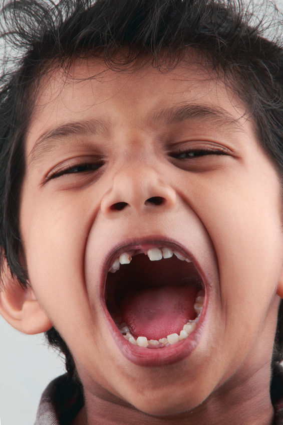 smile-gallery-children Dentistry (4)