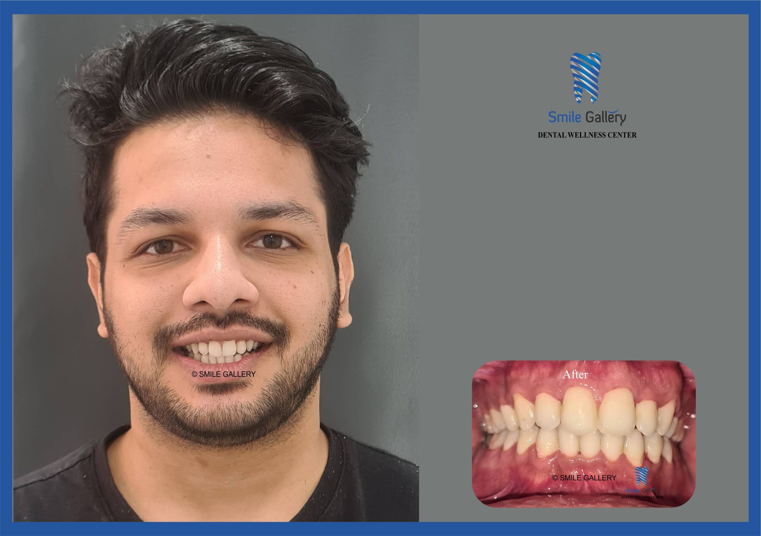 smile dentistry