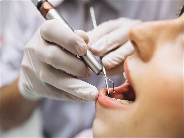 Dental Implants Require Dental Surgery