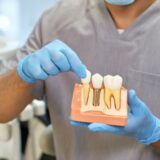 Solution for Missing Teeth: Why Choose Dental Implants