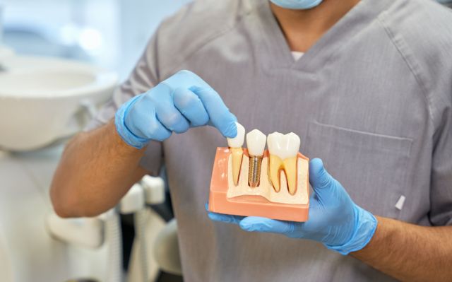 Solution for Missing Teeth: Why Choose Dental Implants