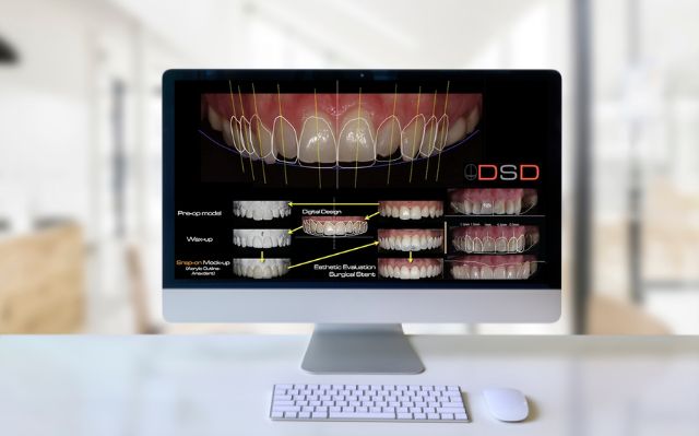 Transform Your Smile with Confidence Through Expert Smile Designing