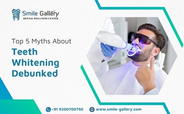 Top 5 Myths About Teeth Whitening Debunked