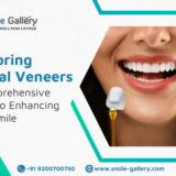 Exploring Dental Veneers A Comprehensive Guide to Enhancing Your Smile