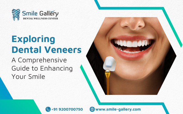 Exploring Dental Veneers A Comprehensive Guide to Enhancing Your Smile