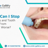 control cavity progression and protect teeth from further decay