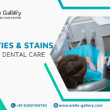 Dentist providing expert dental care to prevent cavities and stains