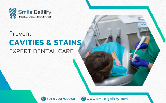 Prevent Cavities and Stains with Expert Dental Care 