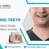 Before and after dental implant smile transformation
