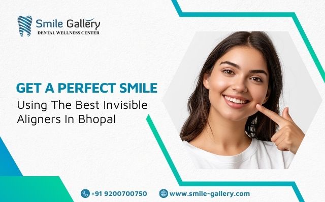 Get a Perfect Smile Using the Best Invisible Aligners in Bhopal