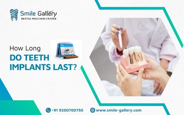 How long do teeth implants last?