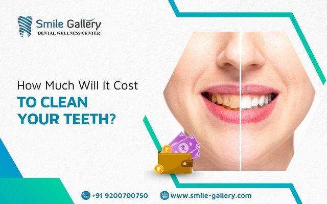 How Much Will It Cost to Clean Your Teeth?