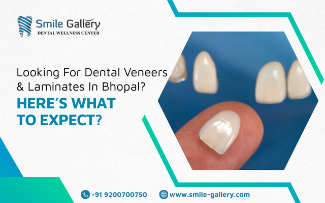 Looking for Dental Veneers and Laminates in Bhopal? Here’s What to Expect