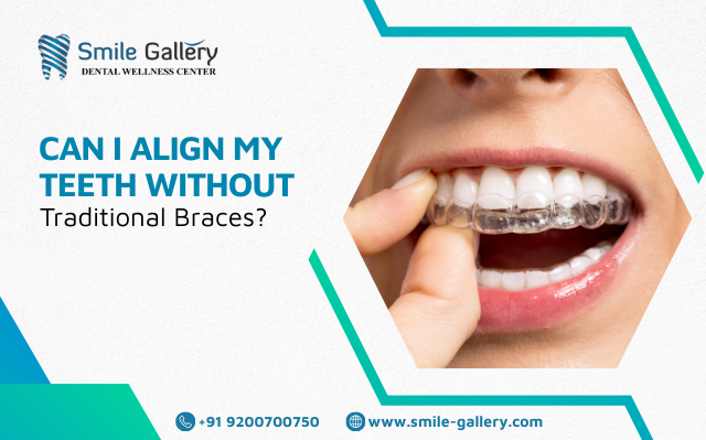 Can I Align My Teeth Without Traditional Braces?