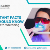 Important Facts You Should Know About Teeth Whitening