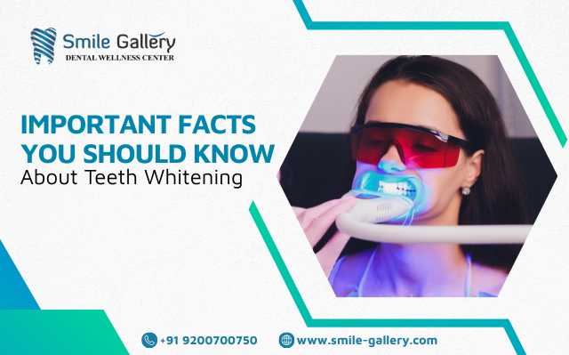 Important Facts You Should Know About Teeth Whitening
