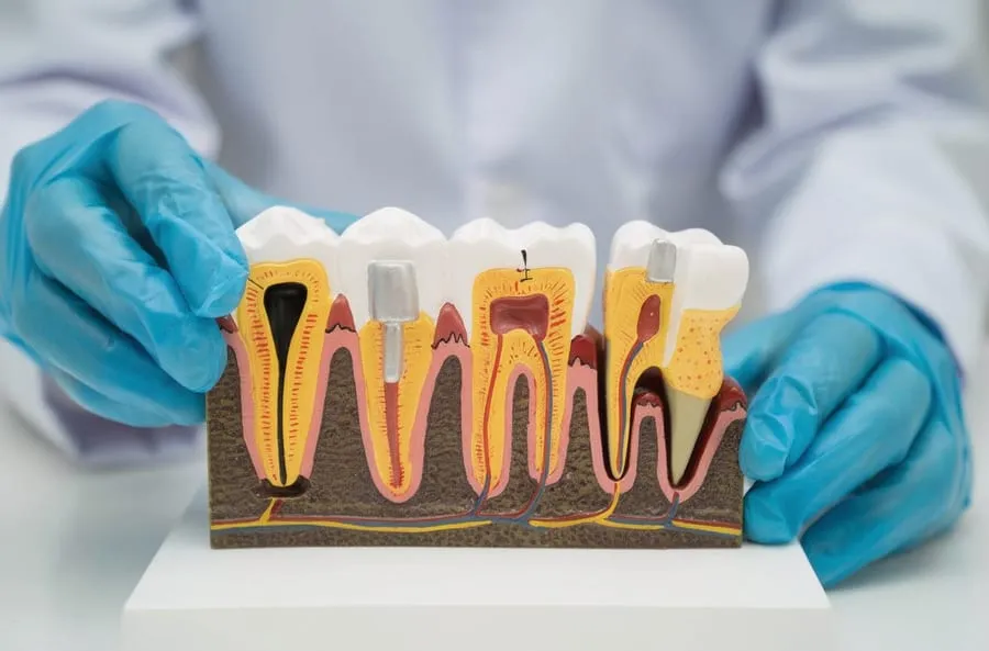 Cross-section anatomical tooth model