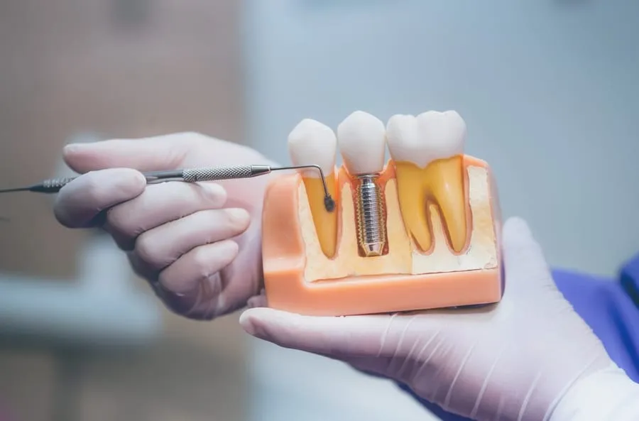Dentist holding jaw model cross-section