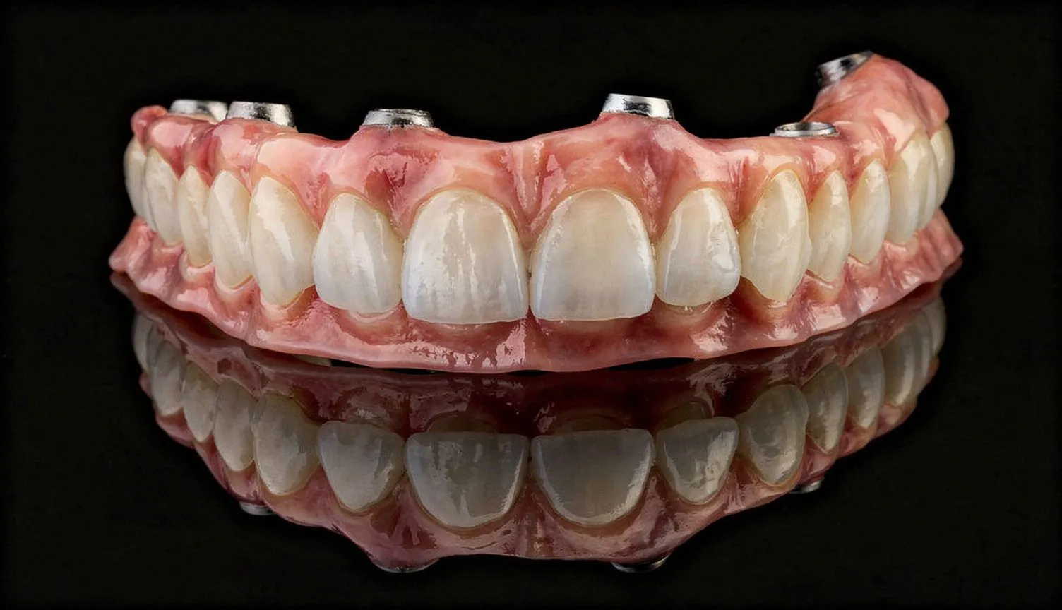 Full-arch implant overdenture on black reflective surface; pink acrylic with silver abutment cylinders; dramatic