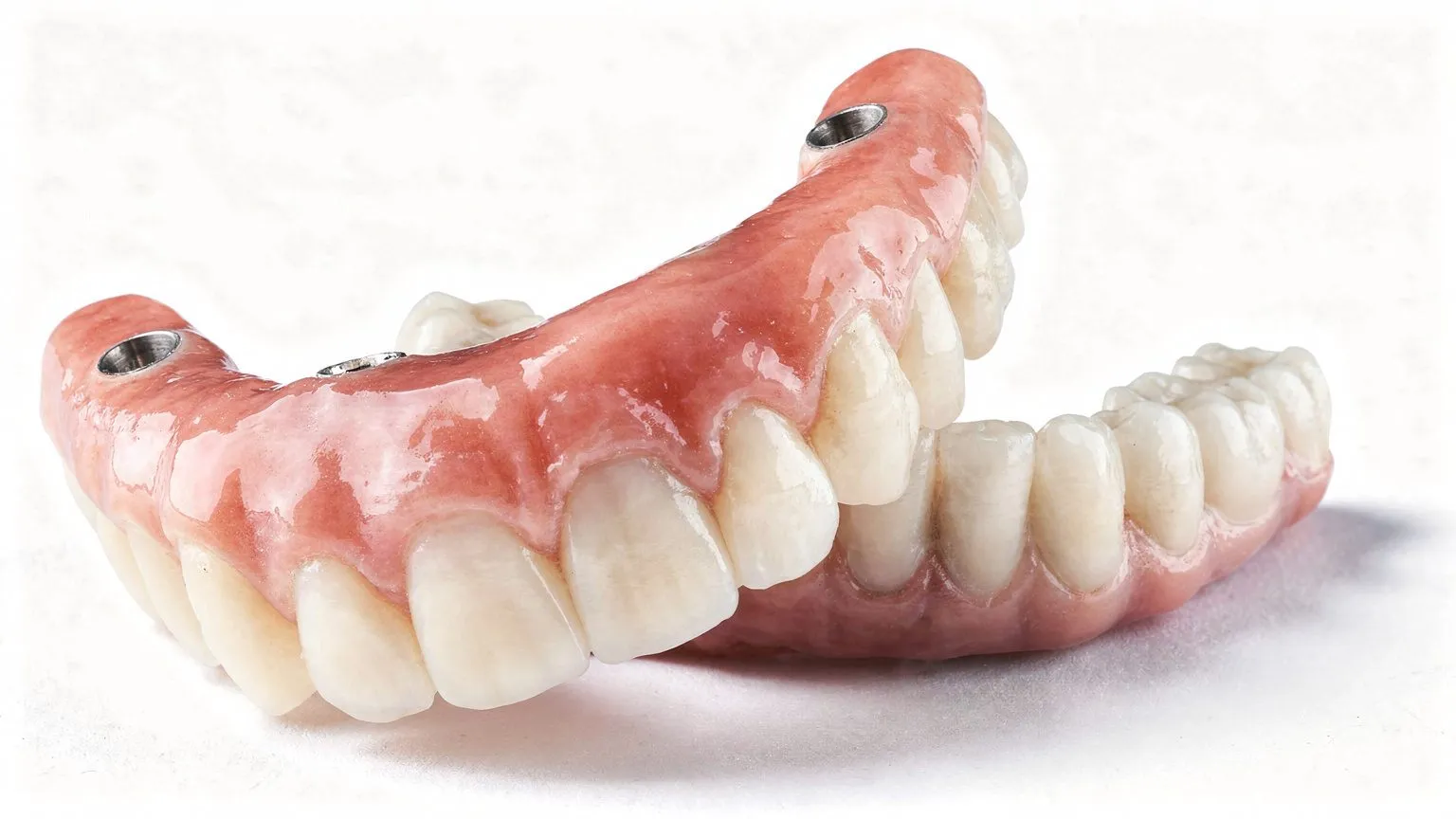 Two implant-supported full denture arches on white surface showing metal abutment attachment points