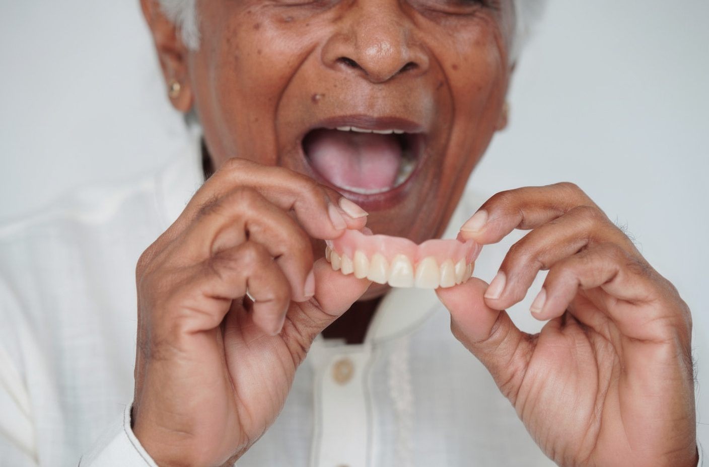 A patient in Bhopal holding a removable full acrylic denture
