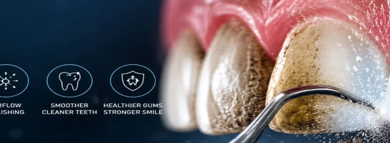 Plaque and Tartar Treatment: Latest Innovations