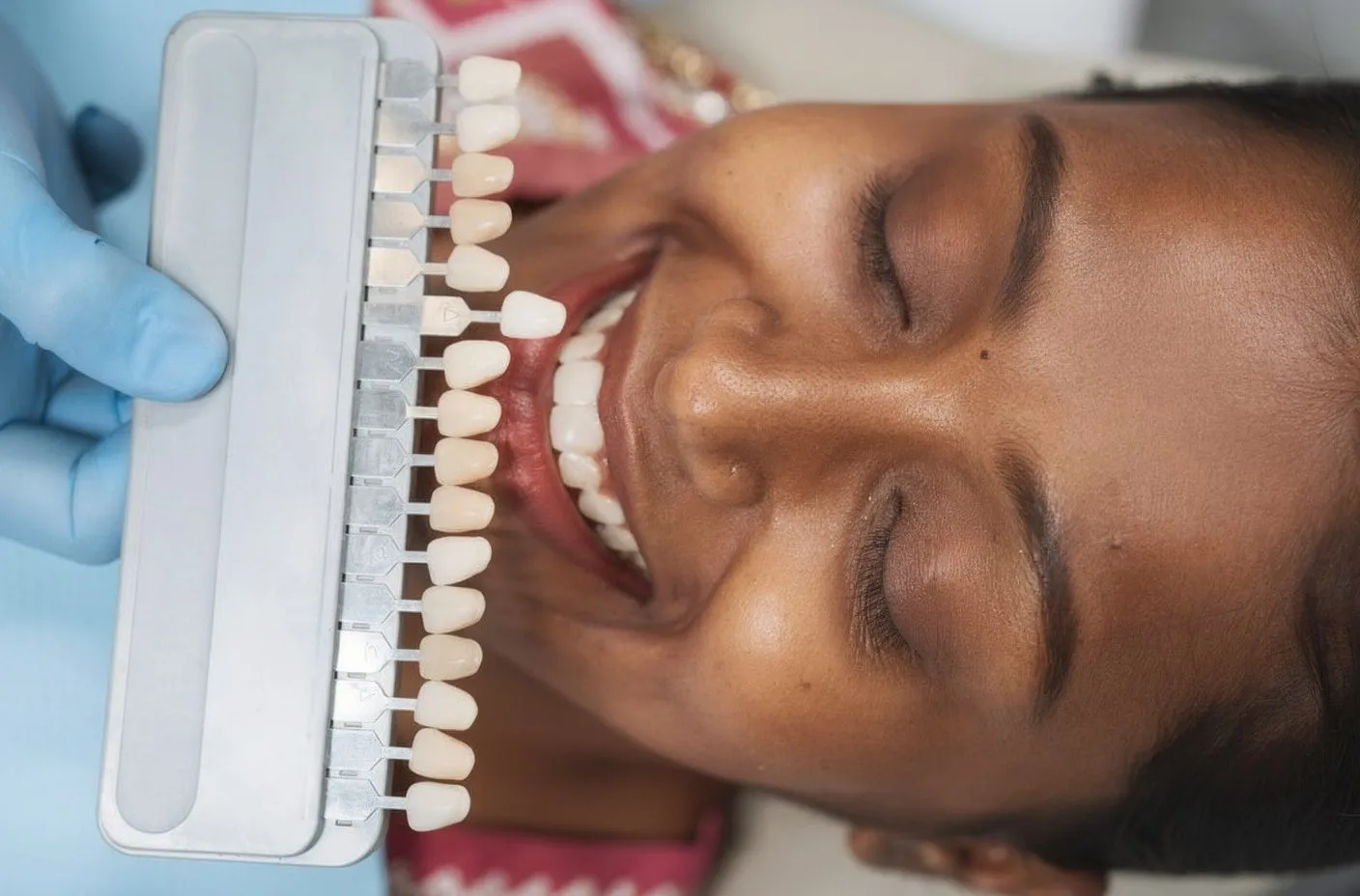 Dentist holding tooth shade guide against dark-skinned patient's open mouth for whitening shade matching